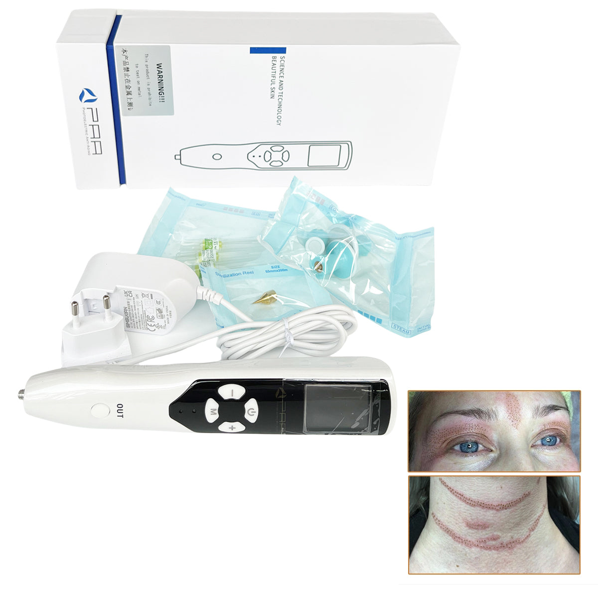 PAA Ozone Fibroblast Plasma Pen Wart Freckle Removal Pen Skin Care Mole Dark Spot Remover Face Lifting Dot Wrinkle Eyelid Lift