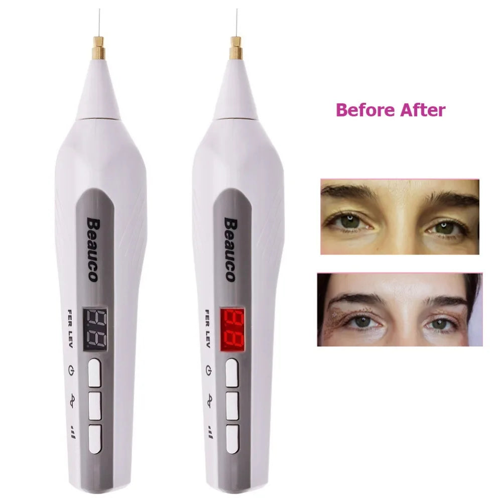 Eyelid Lift Fibroblast Wrinkle Spot Tattoo Mole Removal Plasma Pen plasmapen for  Face Skin Lift