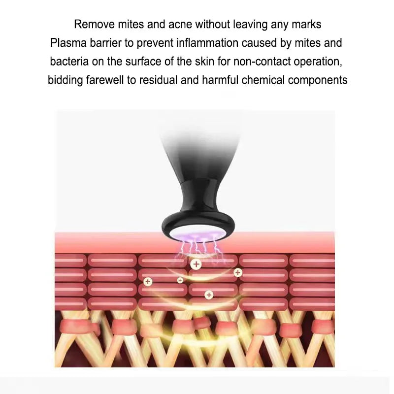 Ozone Plasma Pen Mite Removal, Fading Of Acne Scars And Pits, Repair Of Facial Plasma Beauty Instrument