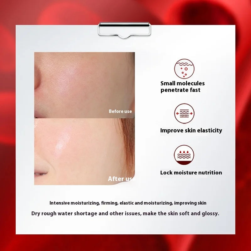 Serum Protein Essence Collagen Exosome Smear Type Child Face Water Light Raw Liquid Umbilical Cord Blood Kinetic Energy